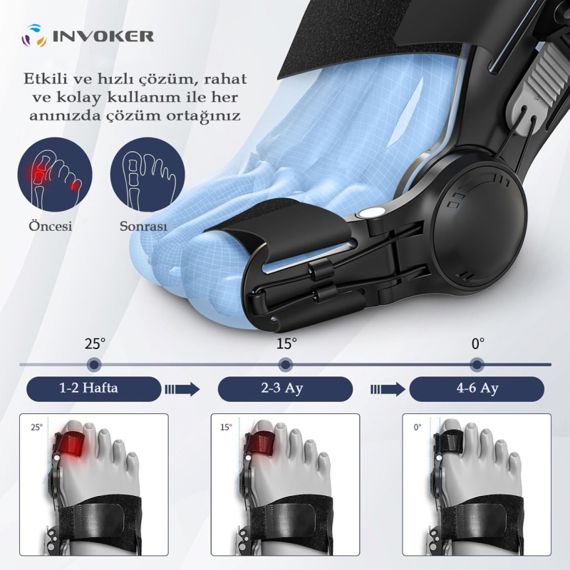 آتل-شب-انگشت-پا-۲-عددی-1761914111-2