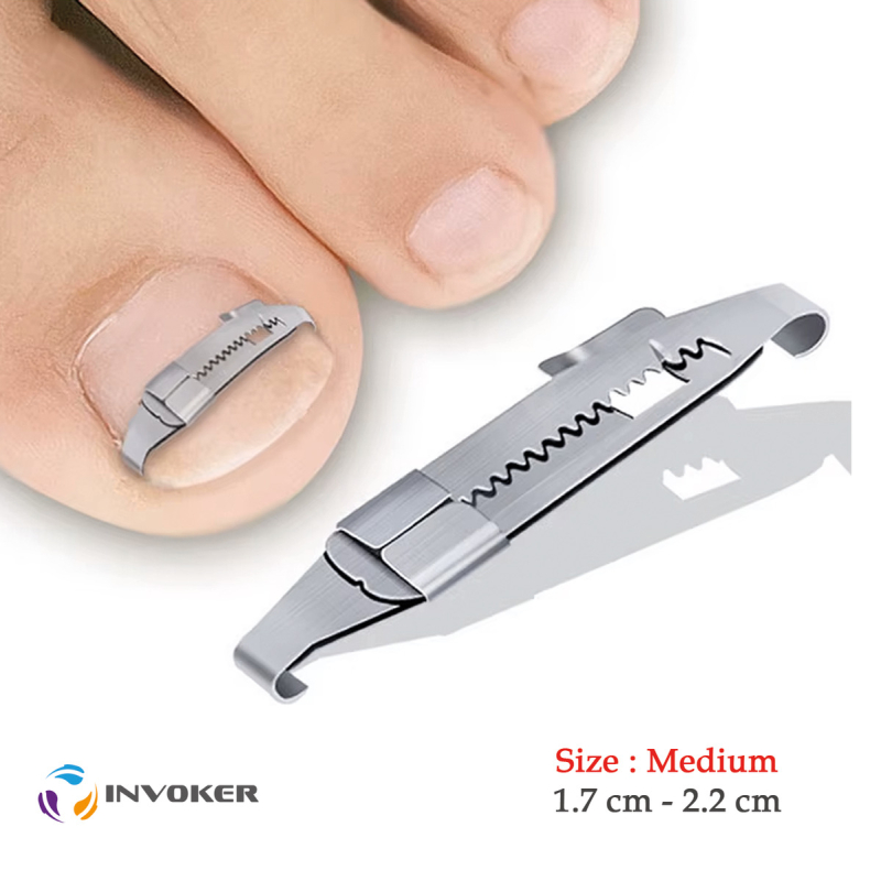 آتل-ناخن-فرورفته-1761913760-1