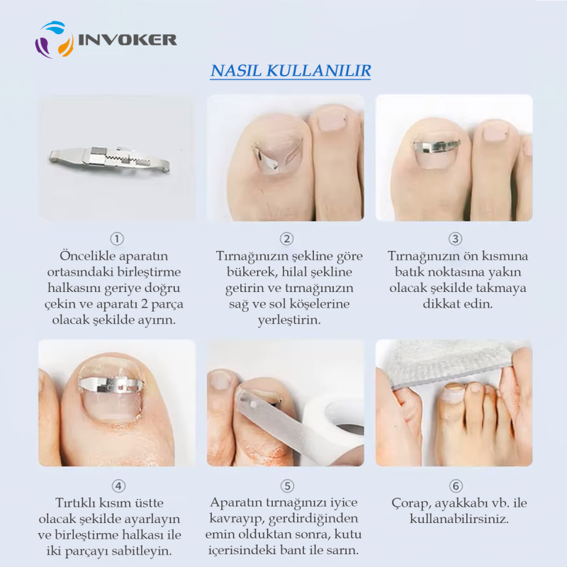 آتل-ناخن-فرورفته-1761913760-6