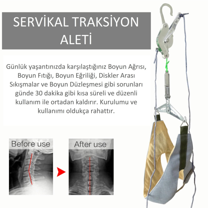 دستگاه-کشش-گردن-1761912936-4
