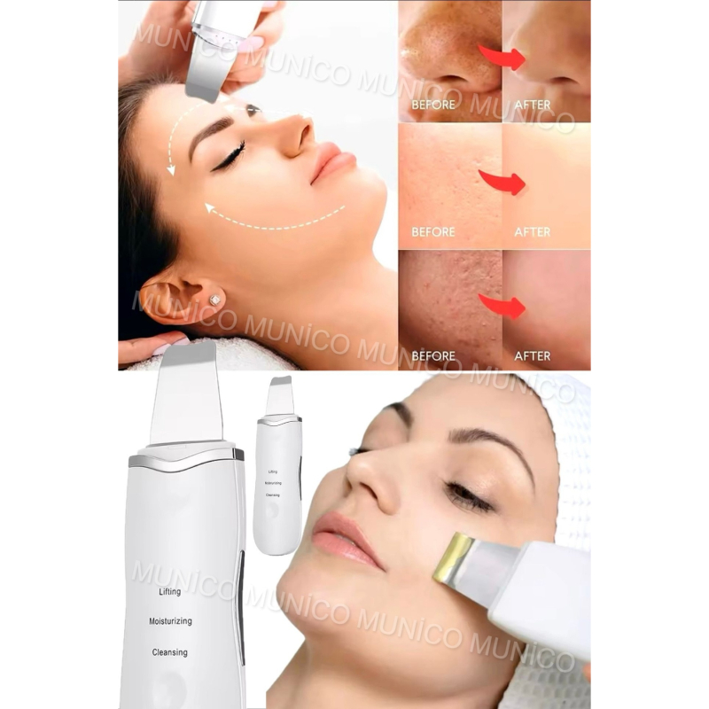 اسپاتولای-پوست-1763907288-1